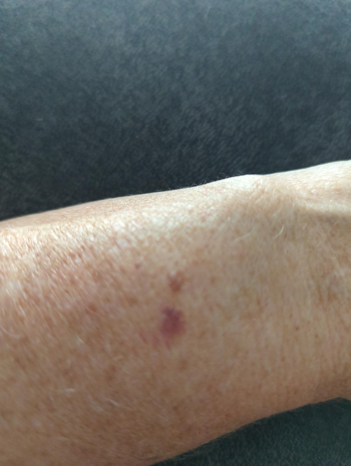 Fitbit Versa 4 Fitness Smartwatch with Daily Readiness, GPS, 24/7 Heart Rate, 40+ Exercise Modes, Sleep Tracking and more, Waterfall Blue/Platinum, One Size (S & L Bands Included) - Customer Photo 1