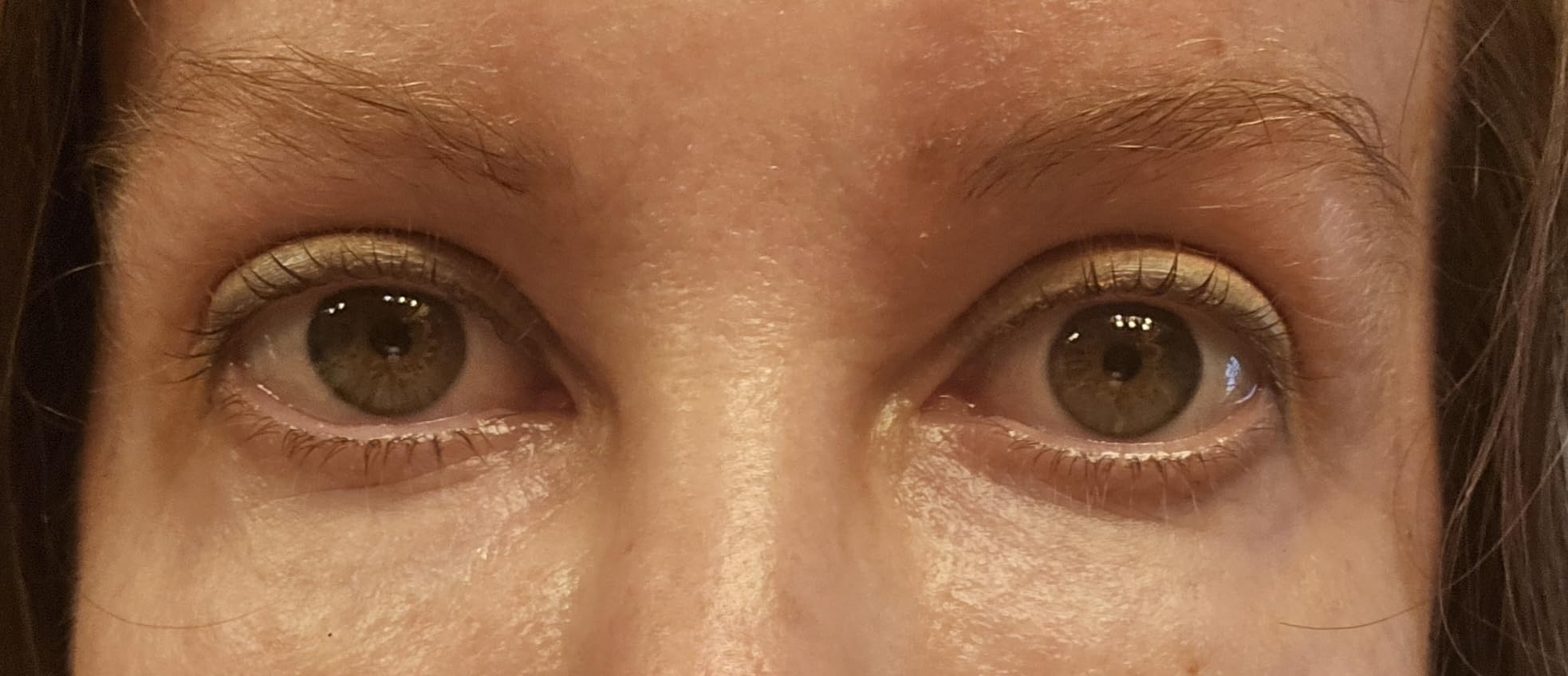 Plexaderm Rapid Reduction Eye Serum - Visibly Reduces Under-Eye Bags, Wrinkles, Dark Circles, Fine Lines & Crow's Feet Instantly, Anti Aging Wrinkle Remover for Face, Full Size Tube - Customer Photo 1