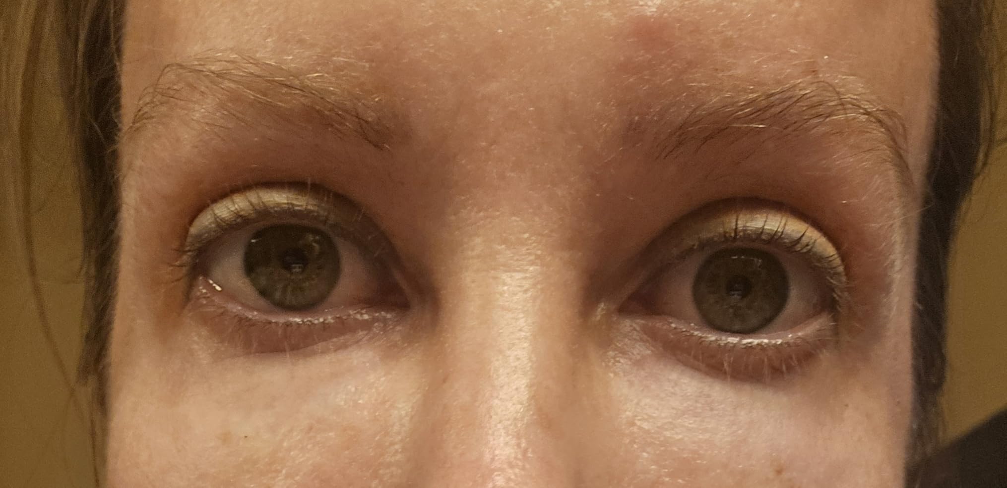 Plexaderm Rapid Reduction Eye Serum - Visibly Reduces Under-Eye Bags, Wrinkles, Dark Circles, Fine Lines & Crow's Feet Instantly, Anti Aging Wrinkle Remover for Face, Full Size Tube - Customer Photo 2