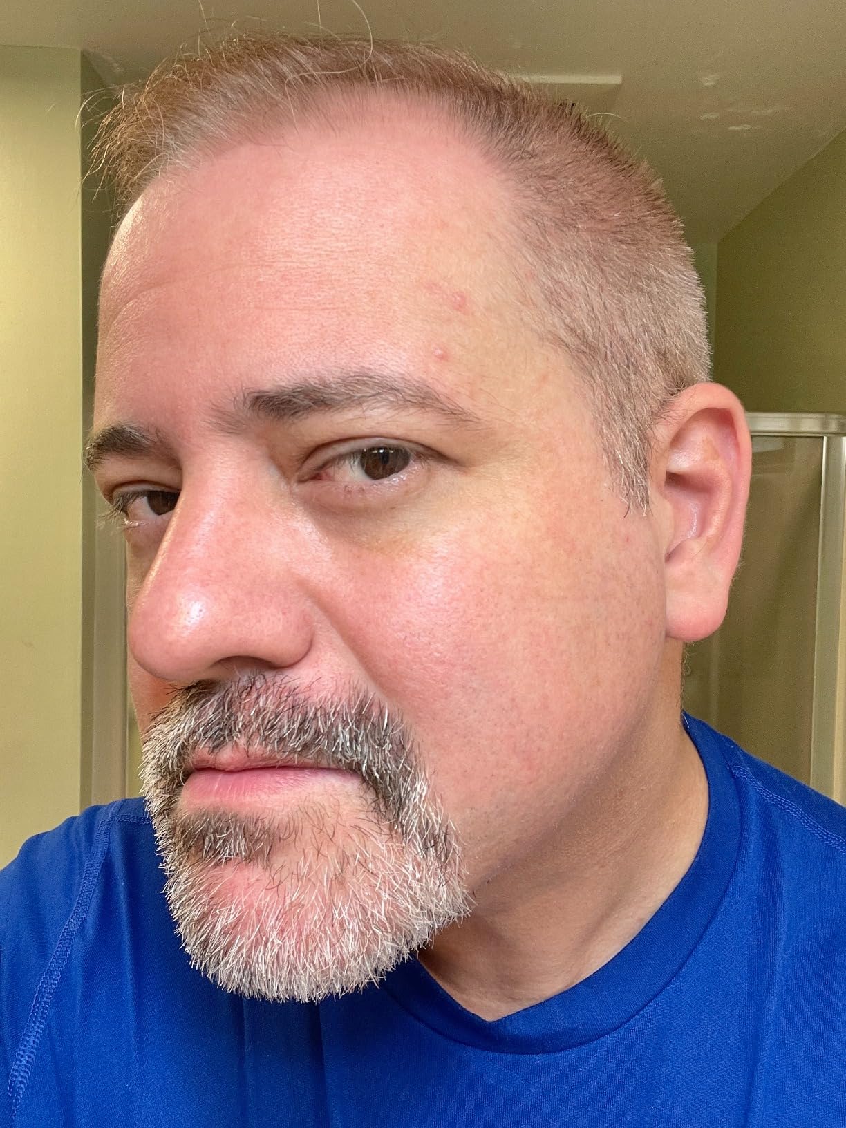 Norelco Philips Beard Trimmer 7000 Series, 100% Waterproof Trimmer for Men, 40 Lock-in Hair Length Settings, BeardSense Power Adaptability, Detail & T-Blade Trimmer Heads, Charging Stand, BT7670/40 - Customer Photo 4