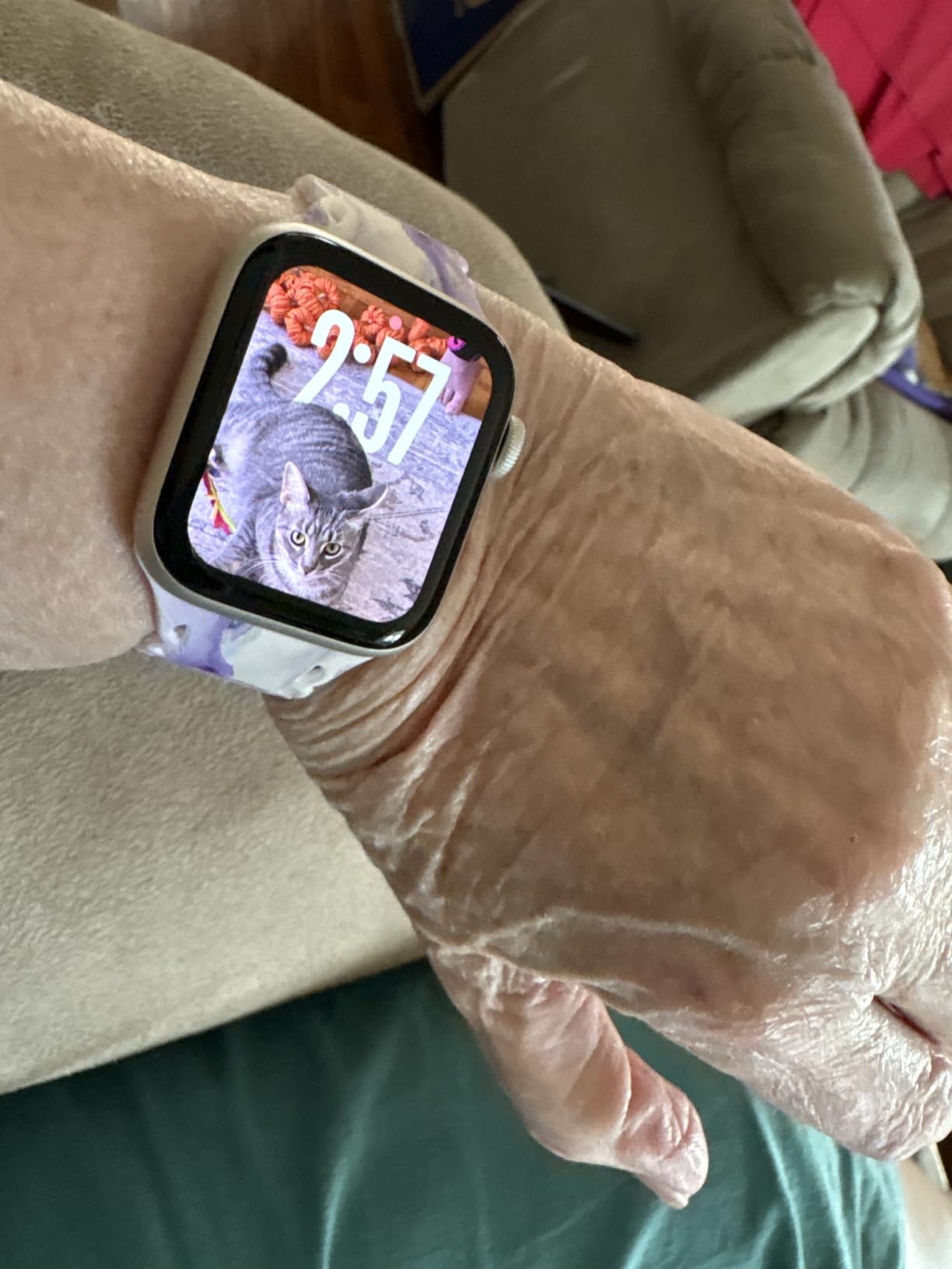 Apple Watch SE 3 [GPS + Cellular 40mm] Smartwatch with Starlight Aluminum Case with Starlight Sport Band - S/M. Fitness and Sleep Trackers, Heart Rate Monitor, Always-On Display, Water Resistant - Customer Photo 1