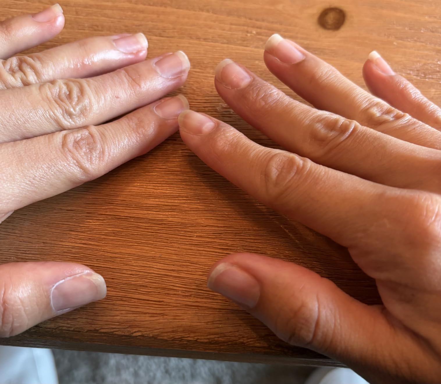 Onyx Professional Hard as Hoof Nail Strengthening Cream, Coconut Scent - Nail Growth and Conditioning Cuticle Cream Stops Splits, Chips, Cracks & Strengthens Nails, 1 oz - Customer Photo 1