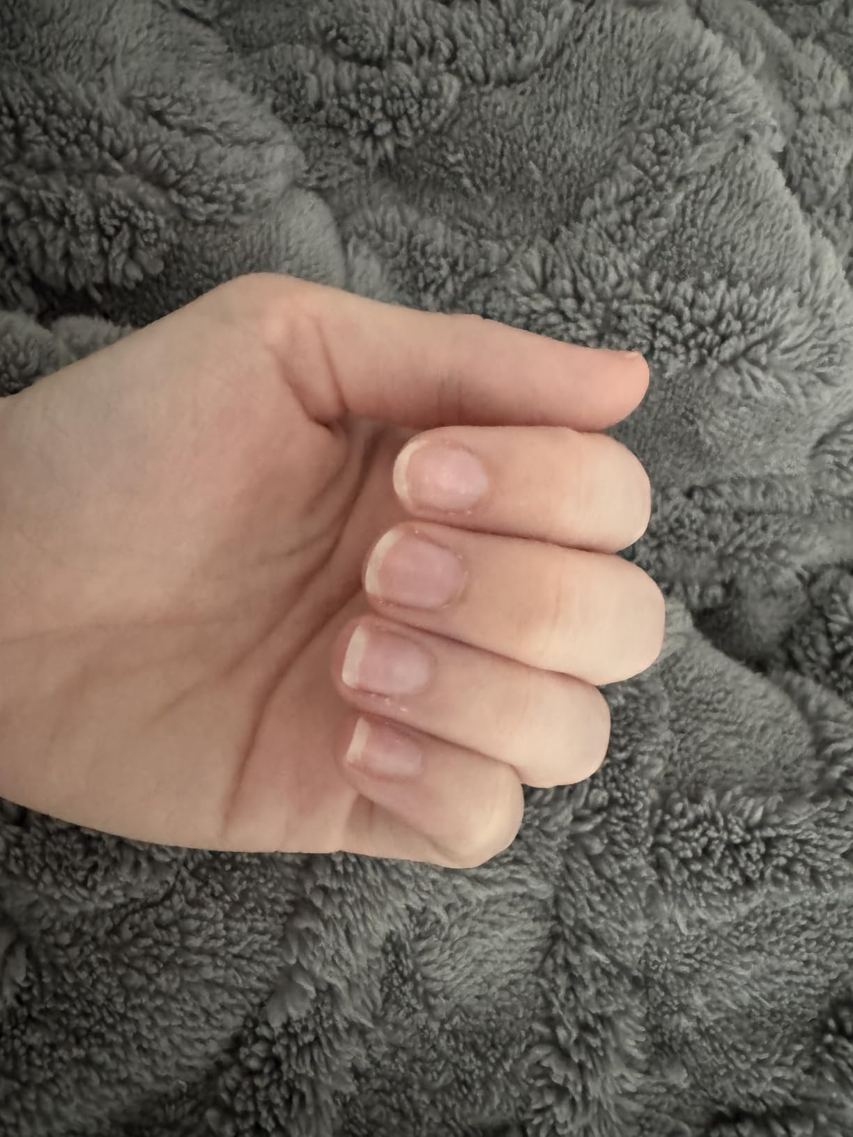 Onyx Professional Hard as Hoof Nail Strengthening Cream, Coconut Scent - Nail Growth and Conditioning Cuticle Cream Stops Splits, Chips, Cracks & Strengthens Nails, 1 oz - Customer Photo 2