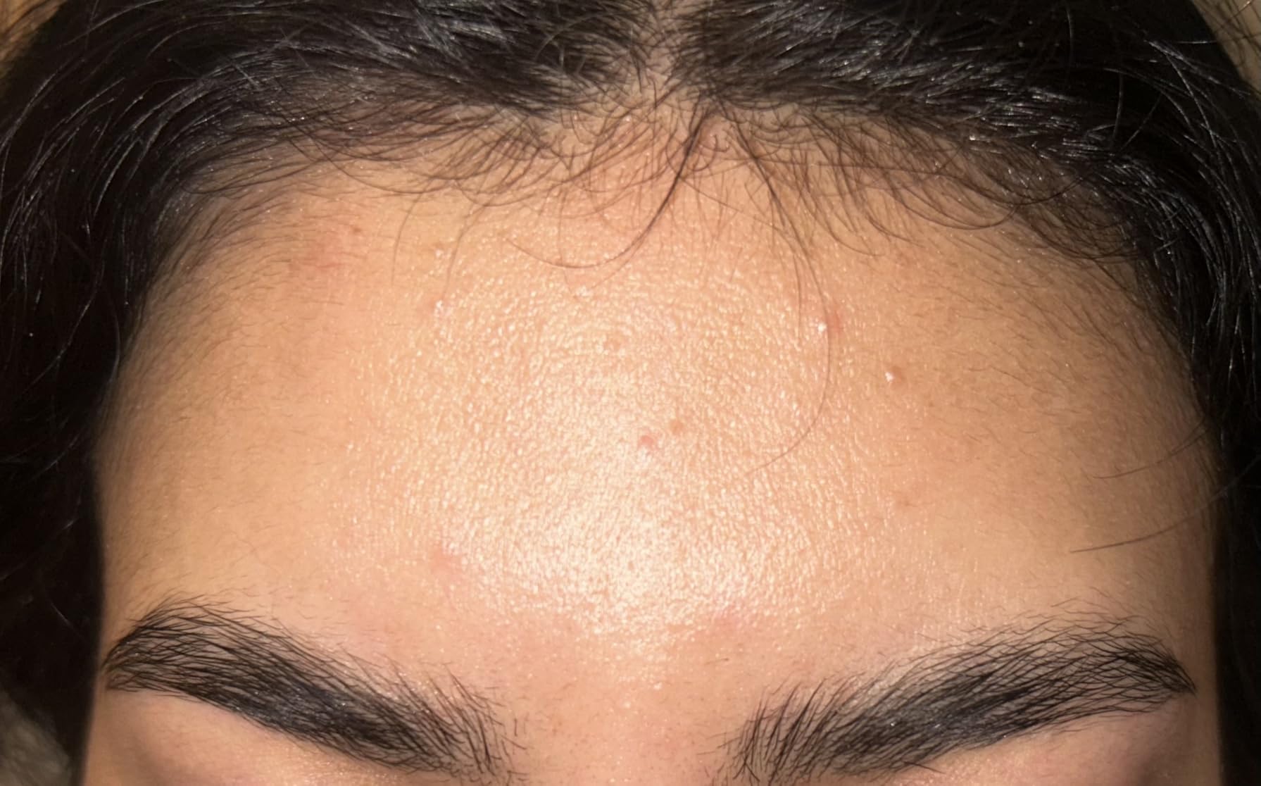 Snail Mucin Repairing Serum 100ml, Hydrating Serum for Face with Snail Secretion Filtrate for Dull Skin & Fine Lines, Korean Skin Care, Stocking Stuffers for Women - Customer Photo 1