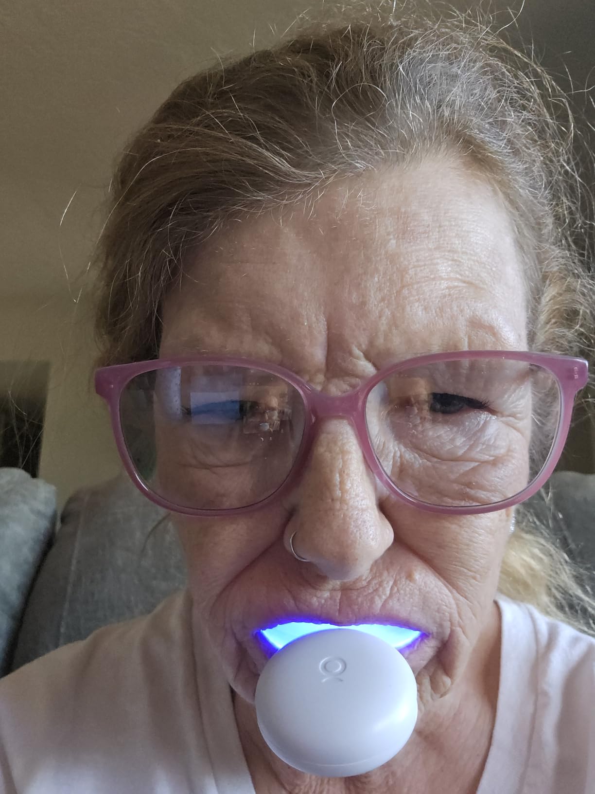 Auraglow Teeth Whitening Kit, LED Accelerator Light, 35% Carbamide Peroxide Teeth Whitening Gel, 20+ Whitening Treatments, Whitens up to 10 Shades in 7 Days - Customer Photo 2