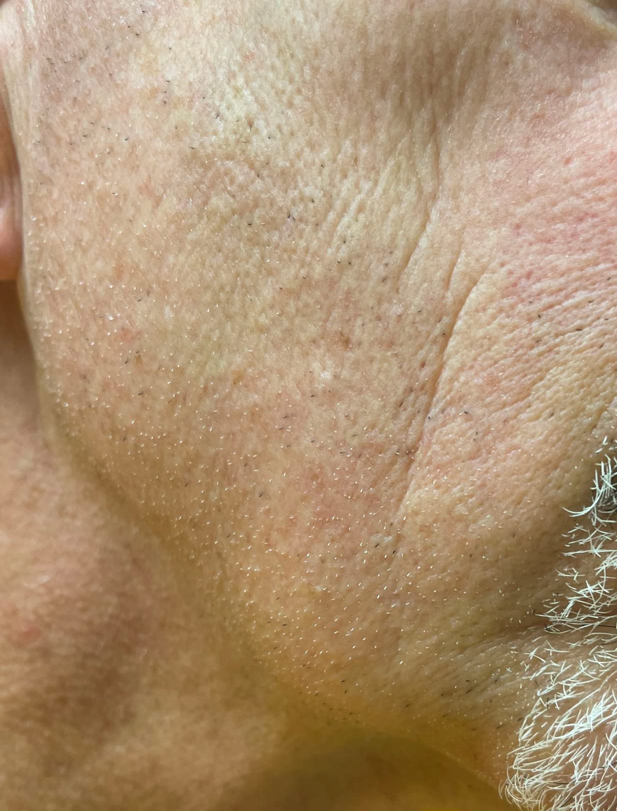 Braun Electric Series 3 Razor with Precision Trimmer, Rechargeable, Wet & Dry Foil Shaver for Men, Blue/Black, 4 Piece - Customer Photo 3