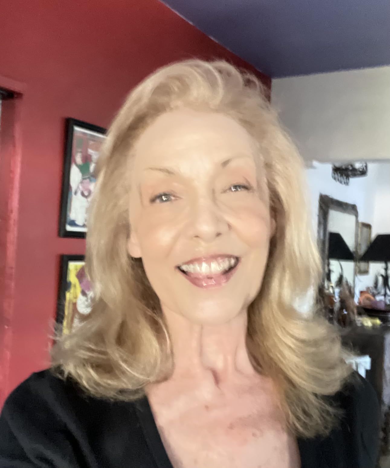 TruSkin Vitamin C Super Serum - Niacinamide, Retinol, Hyaluronic Acid & Squalane - All-in-One Anti Aging Serum for Face – Improve Appearance of Dark Spots, Firmness for Brighter Looking Skin, 1 Fl Oz - Customer Photo 3