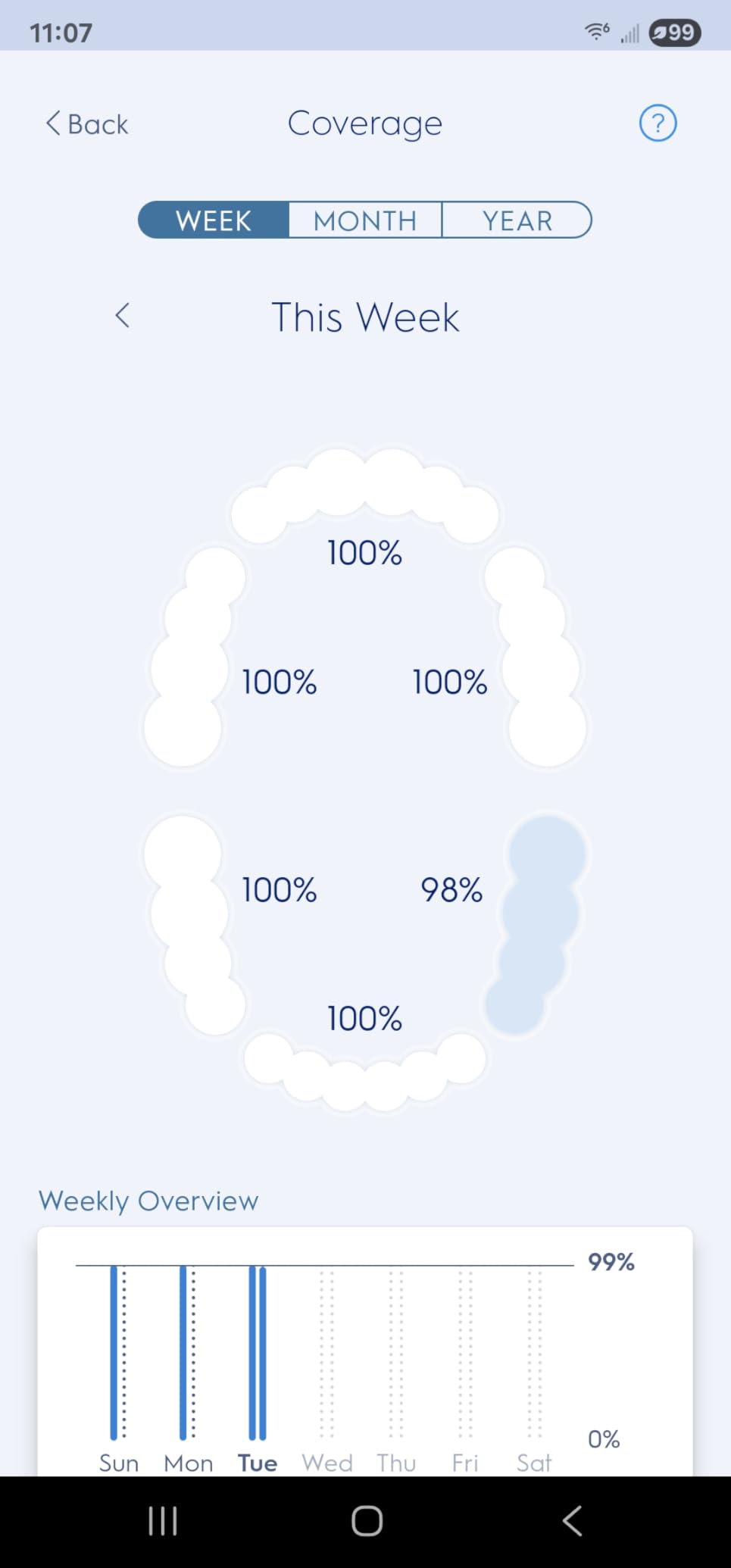 Oral-B Genius X Limited Rechargeable Electric Toothbrush with 1 Replacement Brush Head, Travel Case, White Customer Review Oral-B Genius X Limited Rechargeable Electric Toothbrush with 1 Replacement Brush Head, Travel Case, White - Customer Photo 2