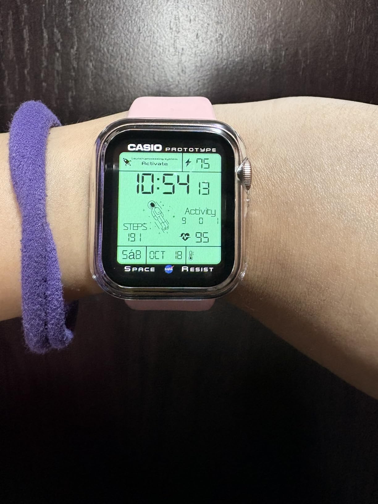 Apple Watch SE (GPS, 40mm) - Gold Aluminum Case with Pink Sand Sport Band (Renewed) Customer Review Apple Watch SE (GPS, 40mm) - Gold Aluminum Case with Pink Sand Sport Band (Renewed) - Customer Photo 1