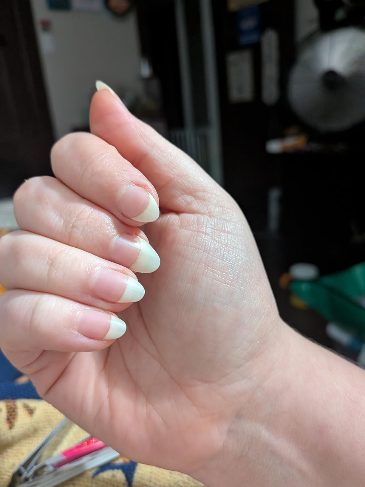 Clean Nutraceuticals Collagen Pills 1000mg Biotin 10000mcg Keratin Saw Palmetto Hyaluronic Acid - Hair Skin & Nails Vitamins & DHT Blocker - Customer Photo 2