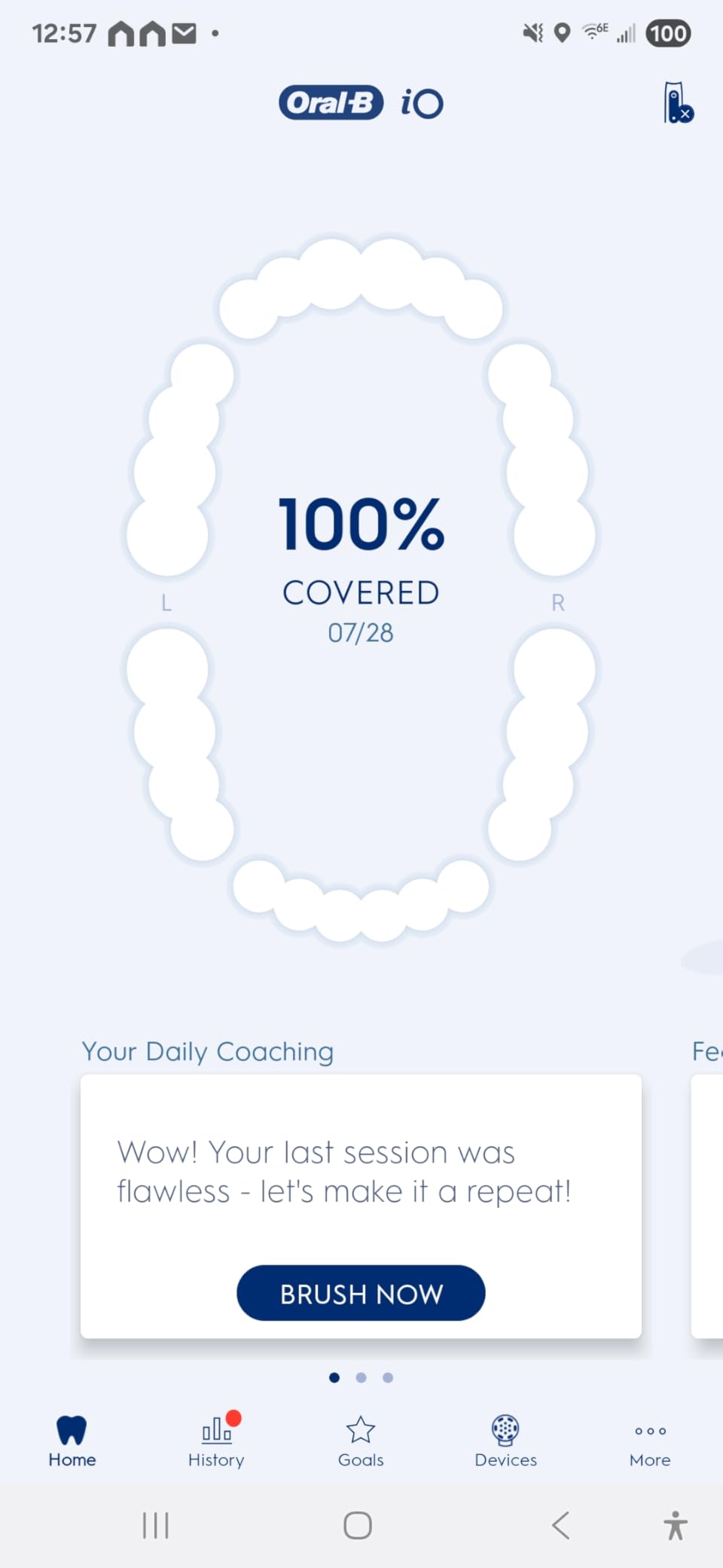 Oral-B iO Deep Clean + Whiten Rechargeable Electric Toothbrush with Visible Pressure Sensor, 2 Minute Timer, 5 Cleaning Settings, 1 iO5 Limited, 3 Toothbrush Heads, Travel Case & Refill Holder, White - Customer Photo 1