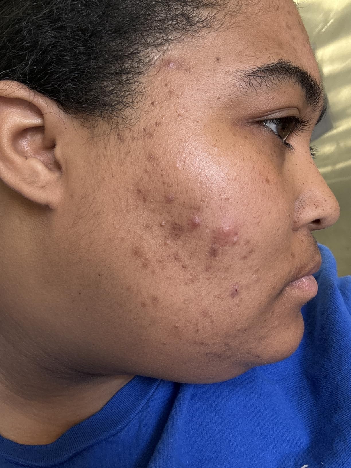 The Face Shop Rice Ceramide Moisturizing Skincare Set - Toner & Moisturizer, Korean Skin Care with Rice Water, Gift Set, Travel Size, Hydrating for Dry Skin - Customer Photo 2