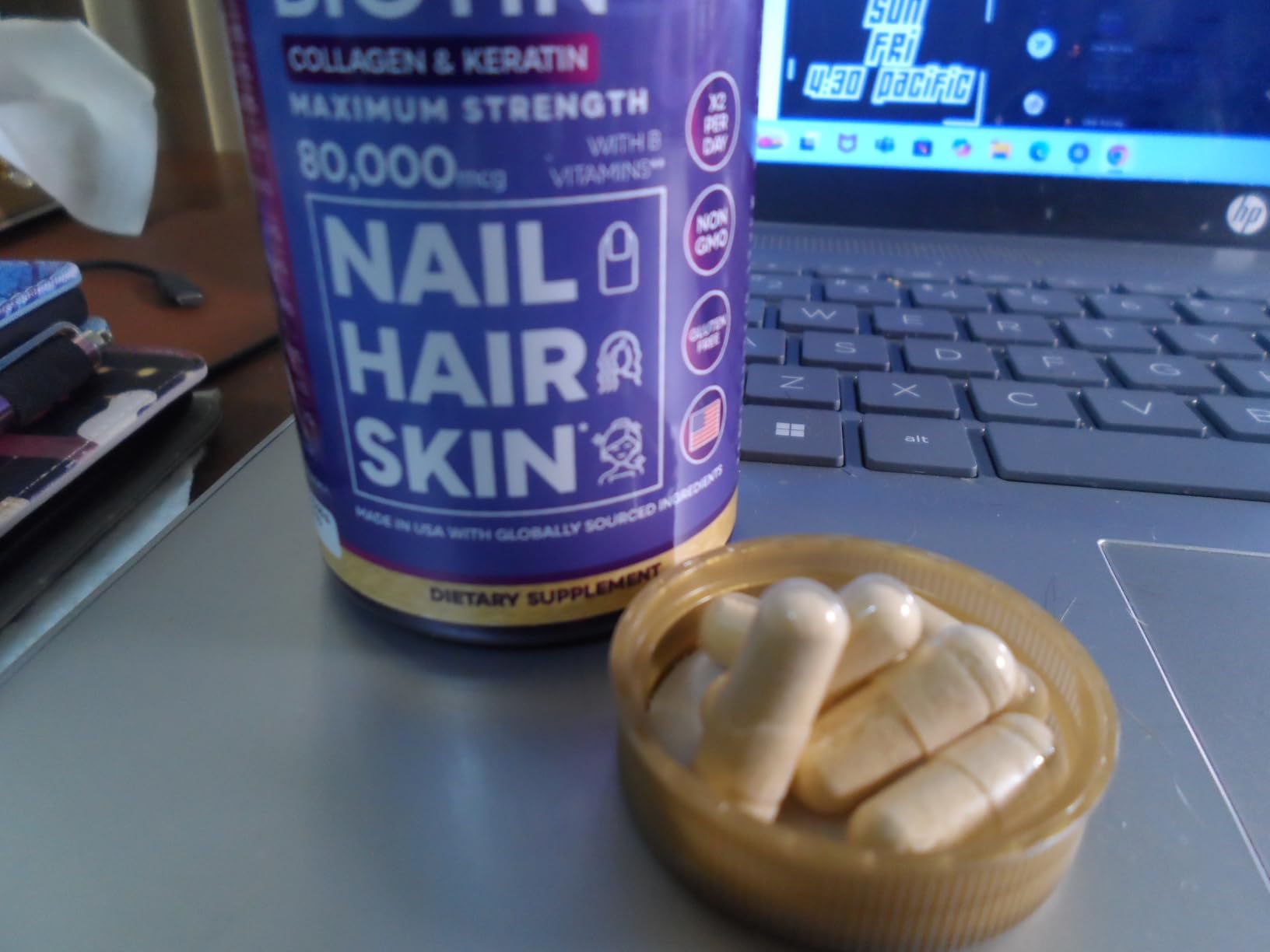 SUNUV Biotin 10,000mcg | Collagen | Keratin - 80,000mcg Hair Growth Vitamins for Women & Men - Customer Photo 1