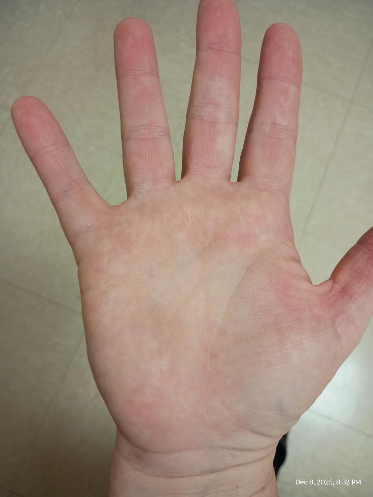 O'Keeffe's Working Hands Hand Cream for Extreme Dryness - 3.4 oz Jar (1 Pack) - Repairing Skincare for Cracked, Dry Hands - Customer Photo 1