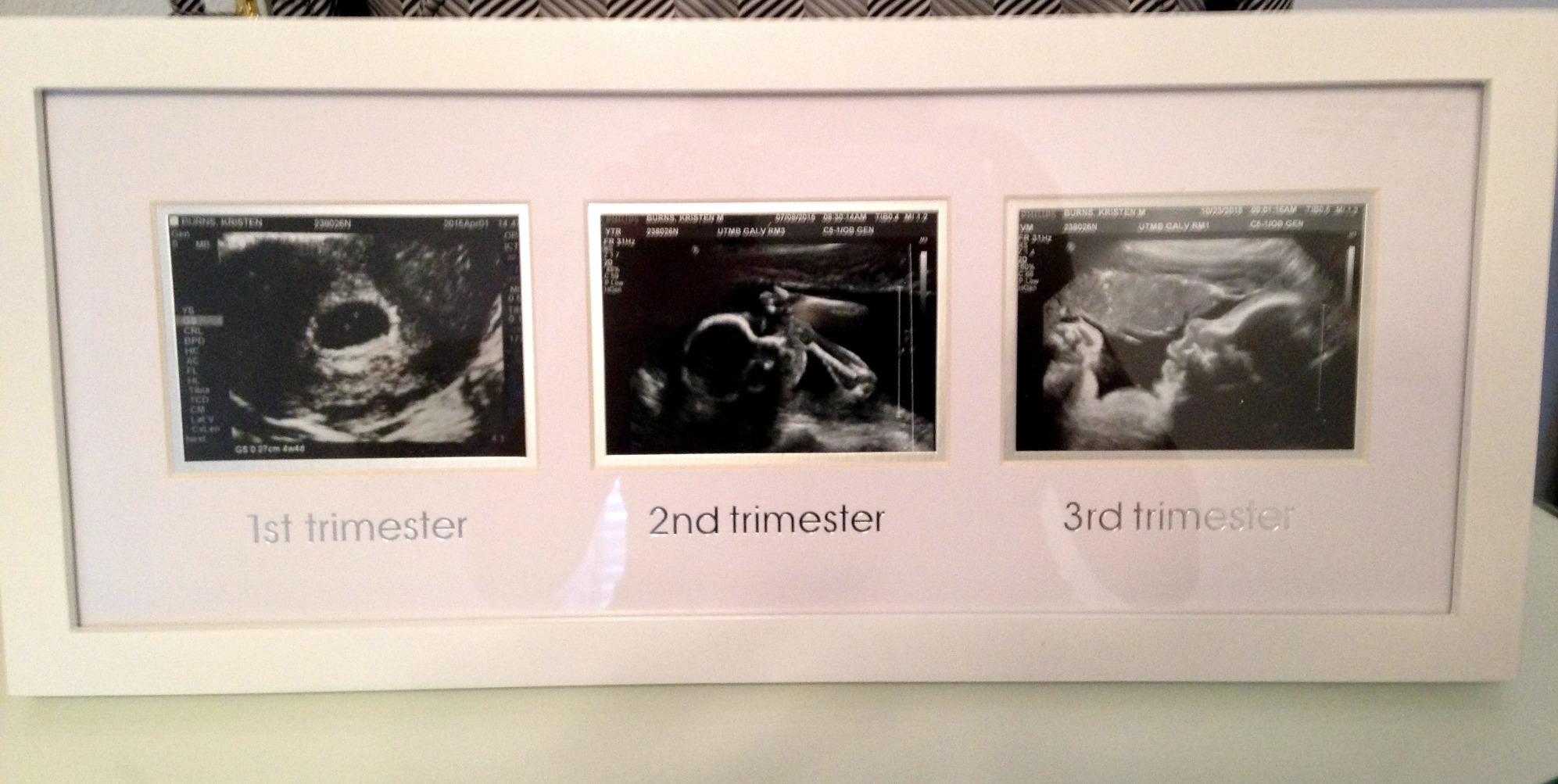 Pearhead Love at First Sight Sonogram Picture Frame, Gender Neutral Ultrasound Keepsake, Ideal Pregnancy Gift, Baby Shower and Nursery Decor, 4
