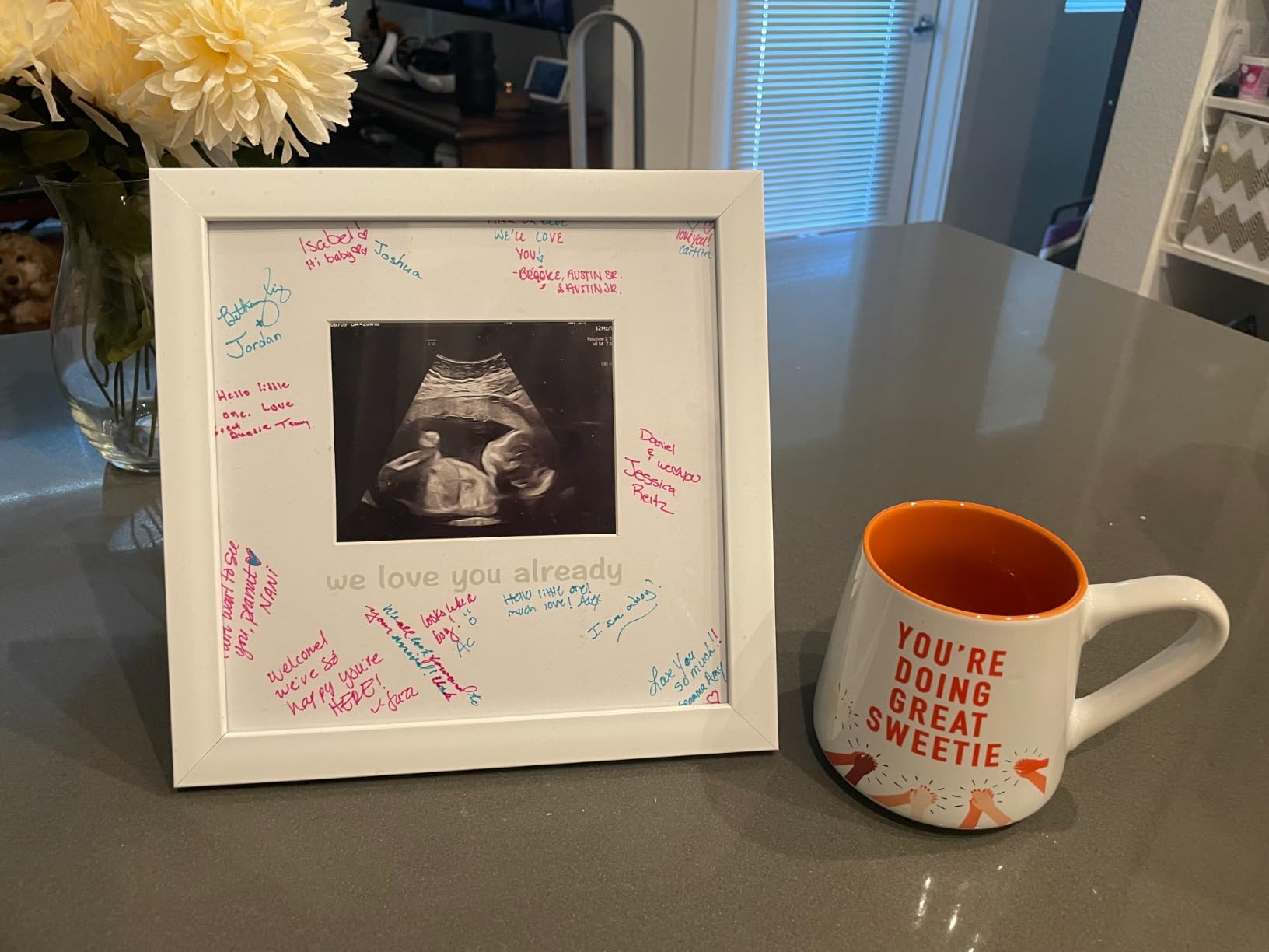 Tiny Ideas Sonogram Signature Frame - Ultrasound Picture Keepsake, Gender Neutral Baby Shower Decor, First Time Moms Pregnancy Gift, Guest Book Alternative, Ideal for Nursery, Marker Included - Customer Photo 1