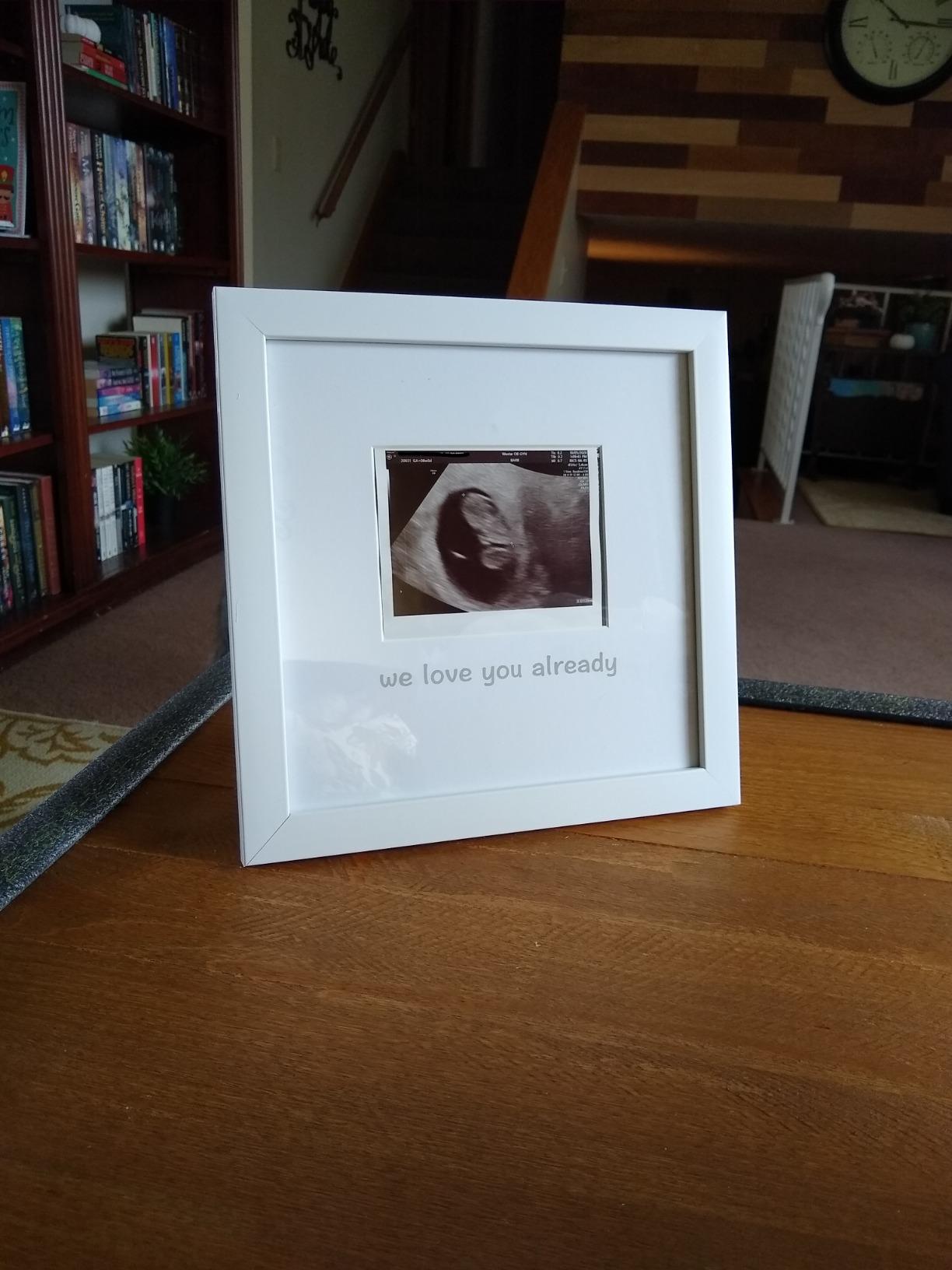 Tiny Ideas Sonogram Signature Frame - Ultrasound Picture Keepsake, Gender Neutral Baby Shower Decor, First Time Moms Pregnancy Gift, Guest Book Alternative, Ideal for Nursery, Marker Included - Customer Photo 2