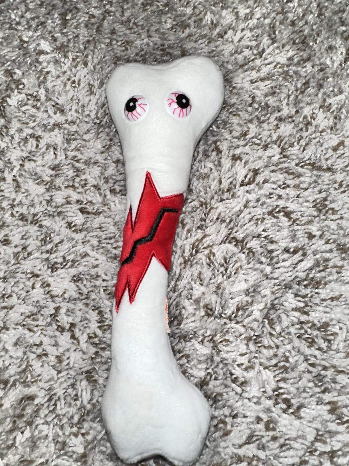 GIANT MICROBES Broken Bone Plush, Funny Orthopedic Surgeon Gifts, Get Well Soon Stuffed Animal, Emotional Support Plush, Orthopedics Model Toy, Broken Leg Care Gifts - Customer Photo 1