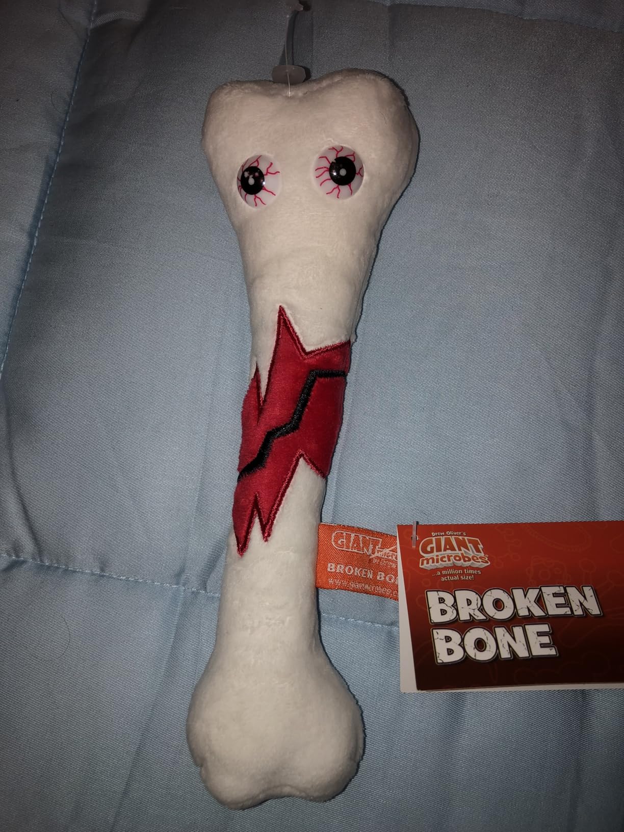 GIANT MICROBES Broken Bone Plush, Funny Orthopedic Surgeon Gifts, Get Well Soon Stuffed Animal, Emotional Support Plush, Orthopedics Model Toy, Broken Leg Care Gifts - Customer Photo 2