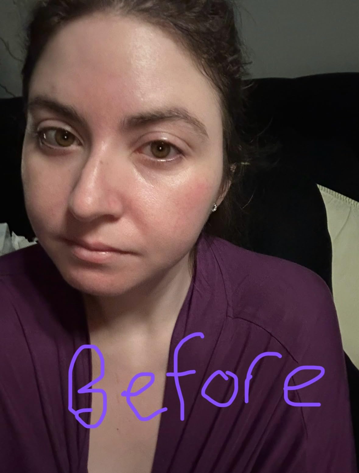 grace & stella Under Eye Brightener with Rose Quartz Rollerball - Hyaluronic Acid & Caffeine Eye Serum for Dark Circles & Puffiness - Travel Size Toiletries, Womens Christmas Gifts (15ml / 0.51floz) - Customer Photo 1