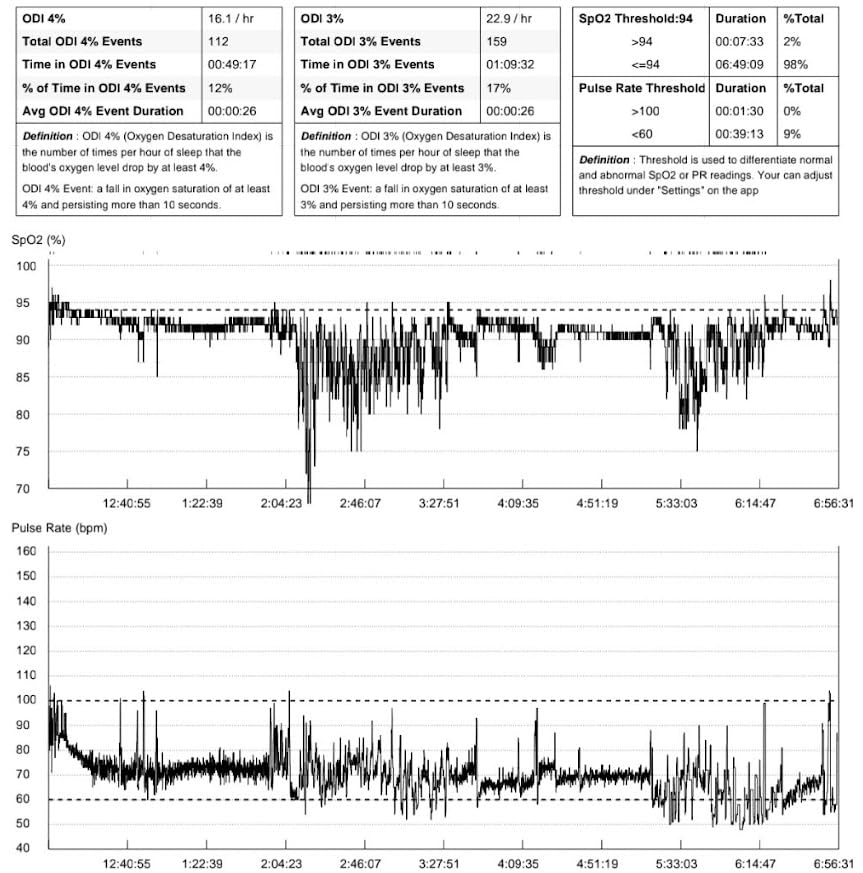 EMAY Sleep Oxygen Monitor with Built-in Recording Capability | Track Continuous Blood Oxygen Levels & Pulse Rate Overnight | Provides Sleep Report & Raw Data - Customer Photo 1