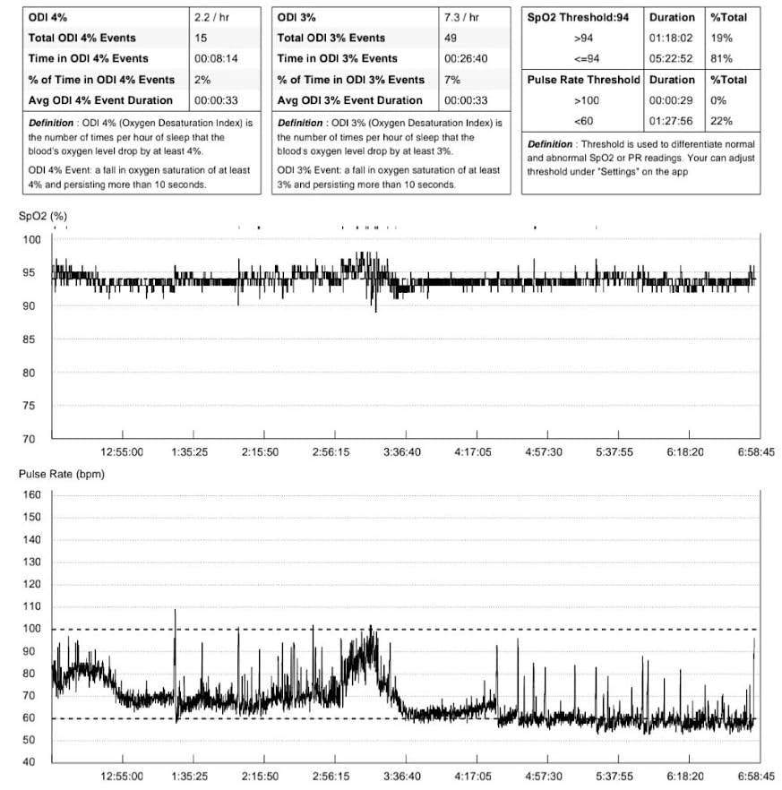 EMAY Sleep Oxygen Monitor with Built-in Recording Capability | Track Continuous Blood Oxygen Levels & Pulse Rate Overnight | Provides Sleep Report & Raw Data - Customer Photo 2