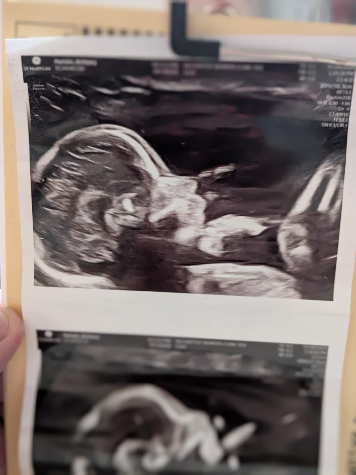 ArtPix 3D Crystal Photo, Valentines Day Personalized Gifts for Women, Wife, Men, Her, Him, Great V-Day Custom Gift With Your Own Photo, Customized Glass 3D Laser Etched Picture Wedding Customer Review ArtPix 3D Crystal Photo, Valentines Day Personalized Gifts for Women, Wife, Men, Her, Him, Great V-Day Custom Gift With Your Own Photo, Customized Glass 3D Laser Etched Picture Wedding - Customer Photo 3