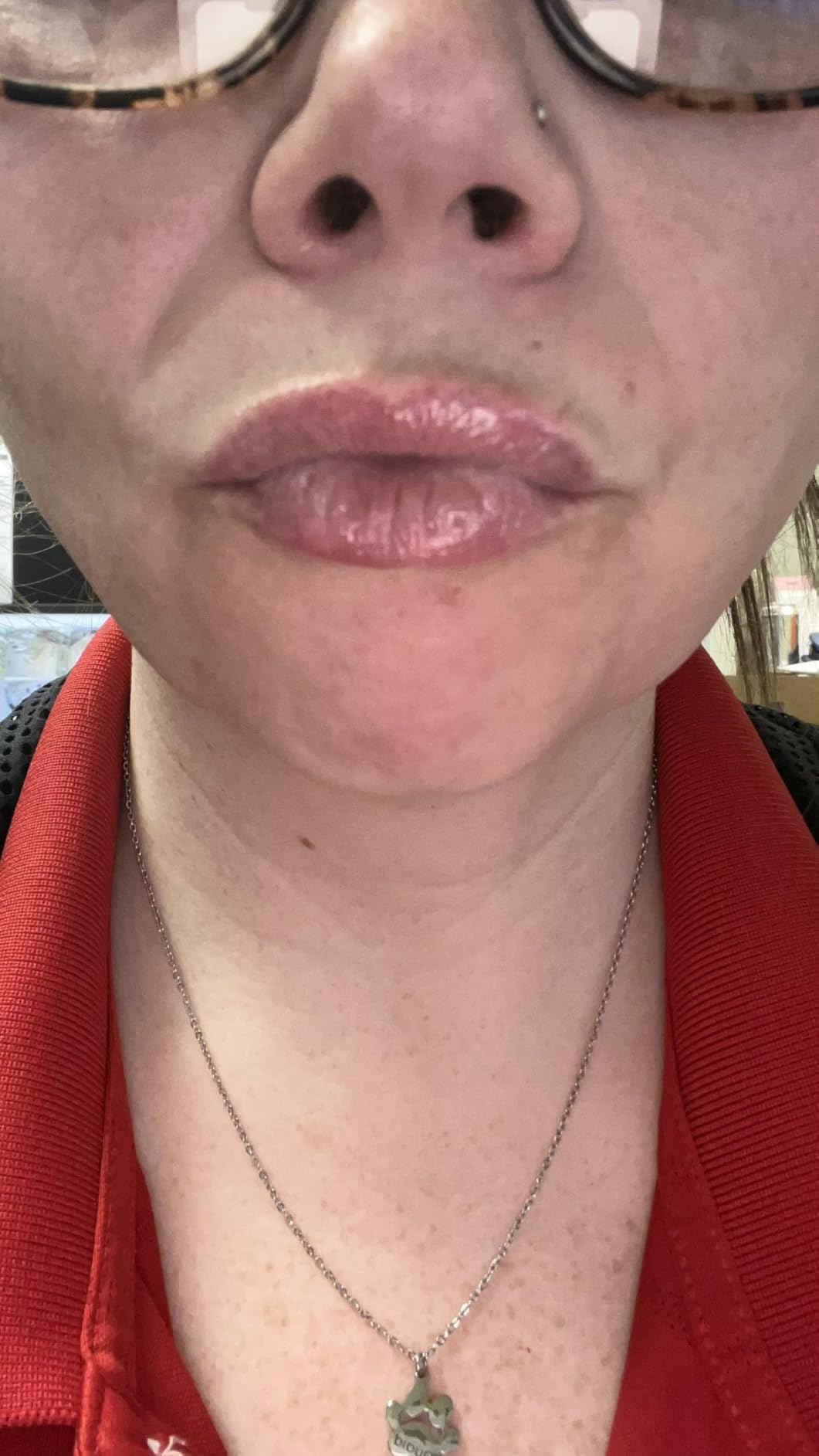 W7 Sweet Dreams Lip Care Gift Set - Overnight Mask, Balm & Scrub - Strawberry - Customer Photo 2