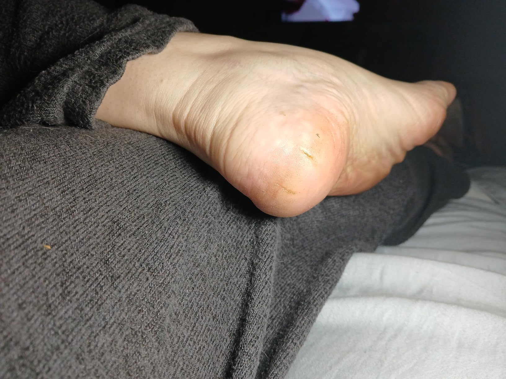 O'Keeffe's for Healthy Feet Foot Cream - 3.2 oz Jar - Guaranteed Relief for Extremely Cracked, Dry Feet customer photo 2