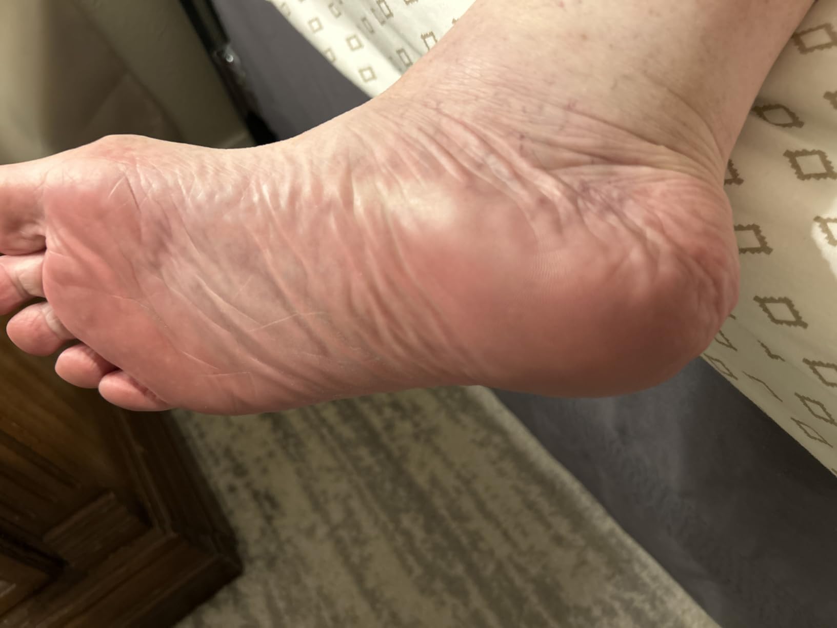 Flexitol Heel Balm, Cracked Heel Cream & Foot Balm, Intensive Hydration for Dry, Rough Feet & Heels, 4 oz Tube customer photo 1