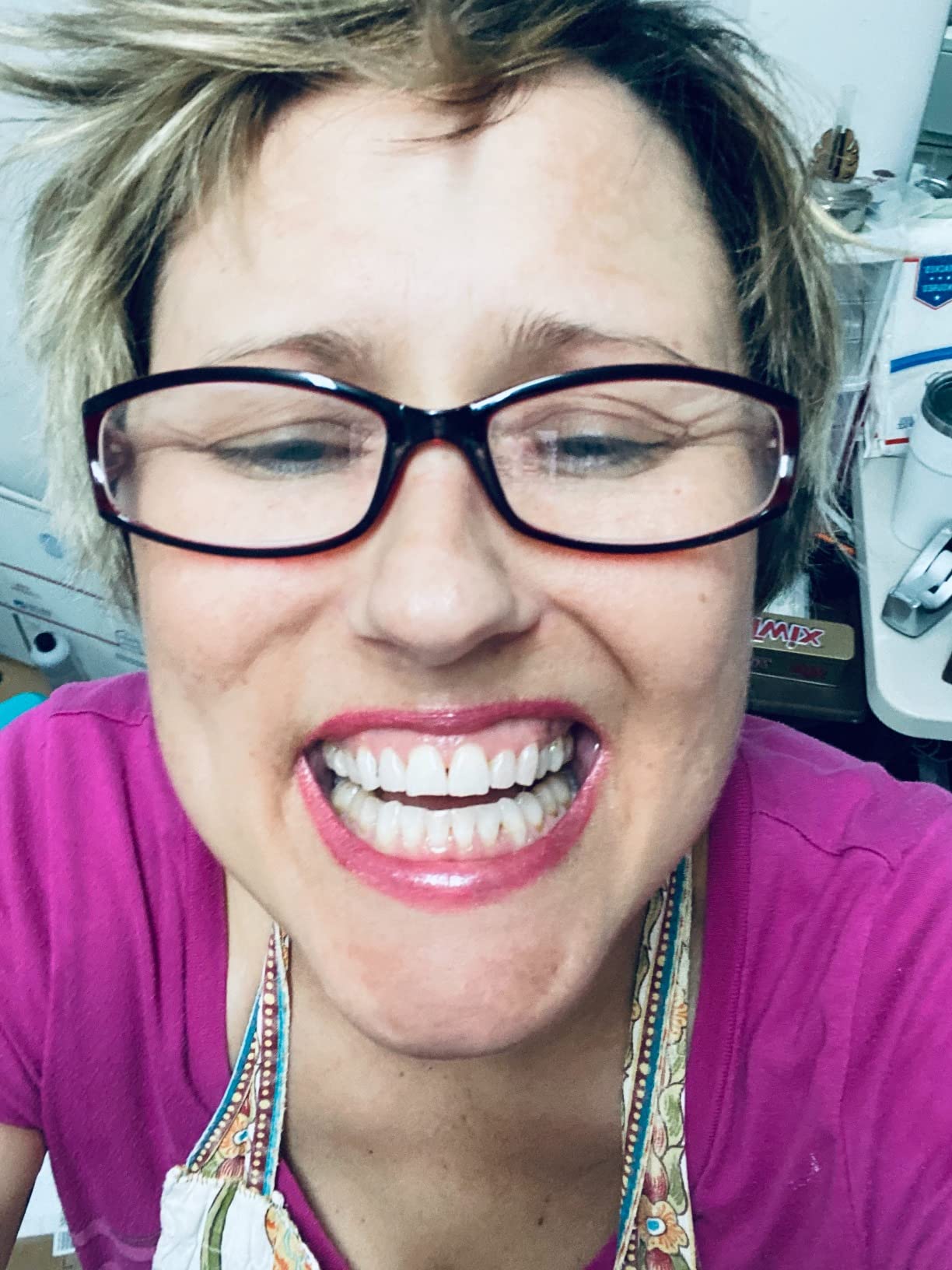 Custom Teeth Whitening Trays (Upper+Lower Set) customer photo 1