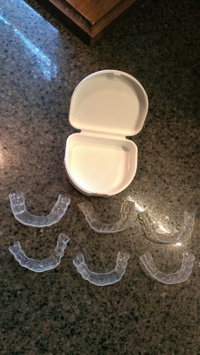 Professional Custom Teeth Whitening Tray Kit. Dental Lab Direct, Custom Made Teeth Whitening Tray, U.S.A Made Bleaching Trays with 38% High Intensity Gel Fast Results Custom Upper and Lower Trays customer photo 1
