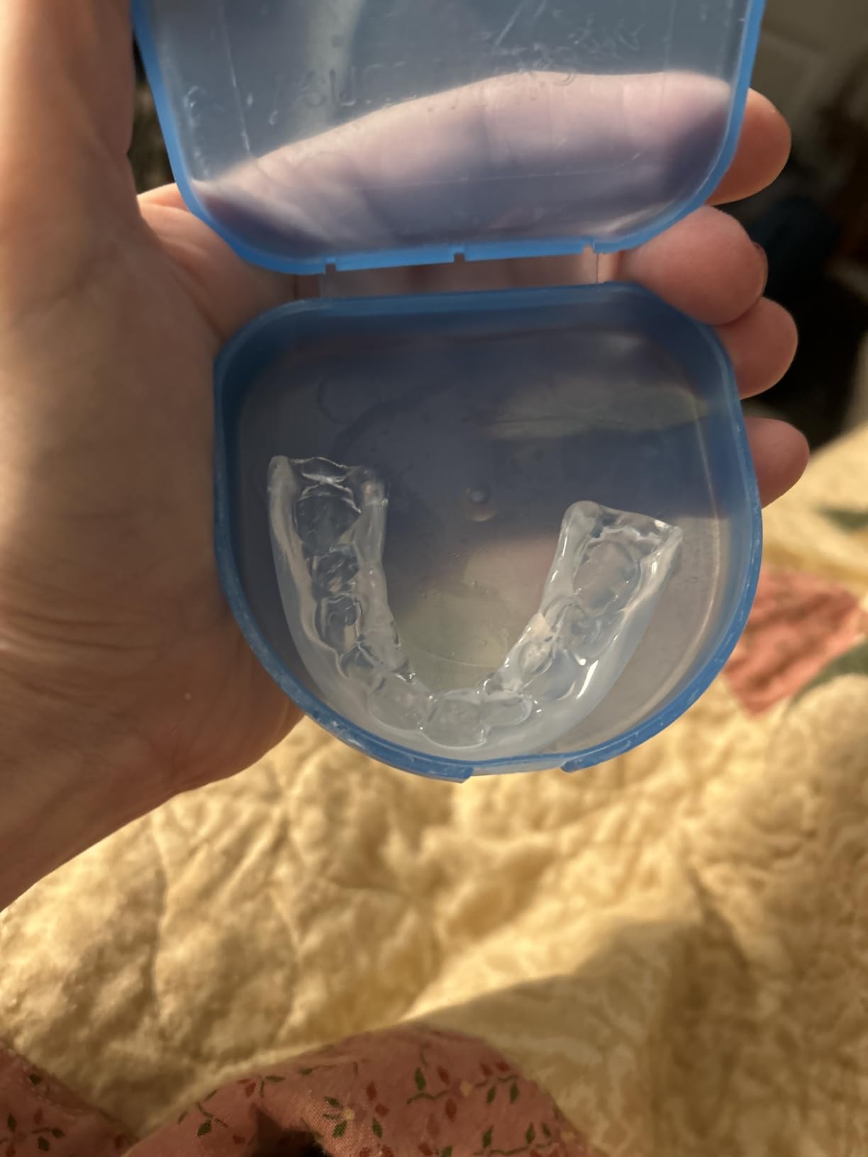 DenTek Professional-Fit Dental Guard, Mouth Guard for Grinding Teeth at Night, 1 Count customer photo 1