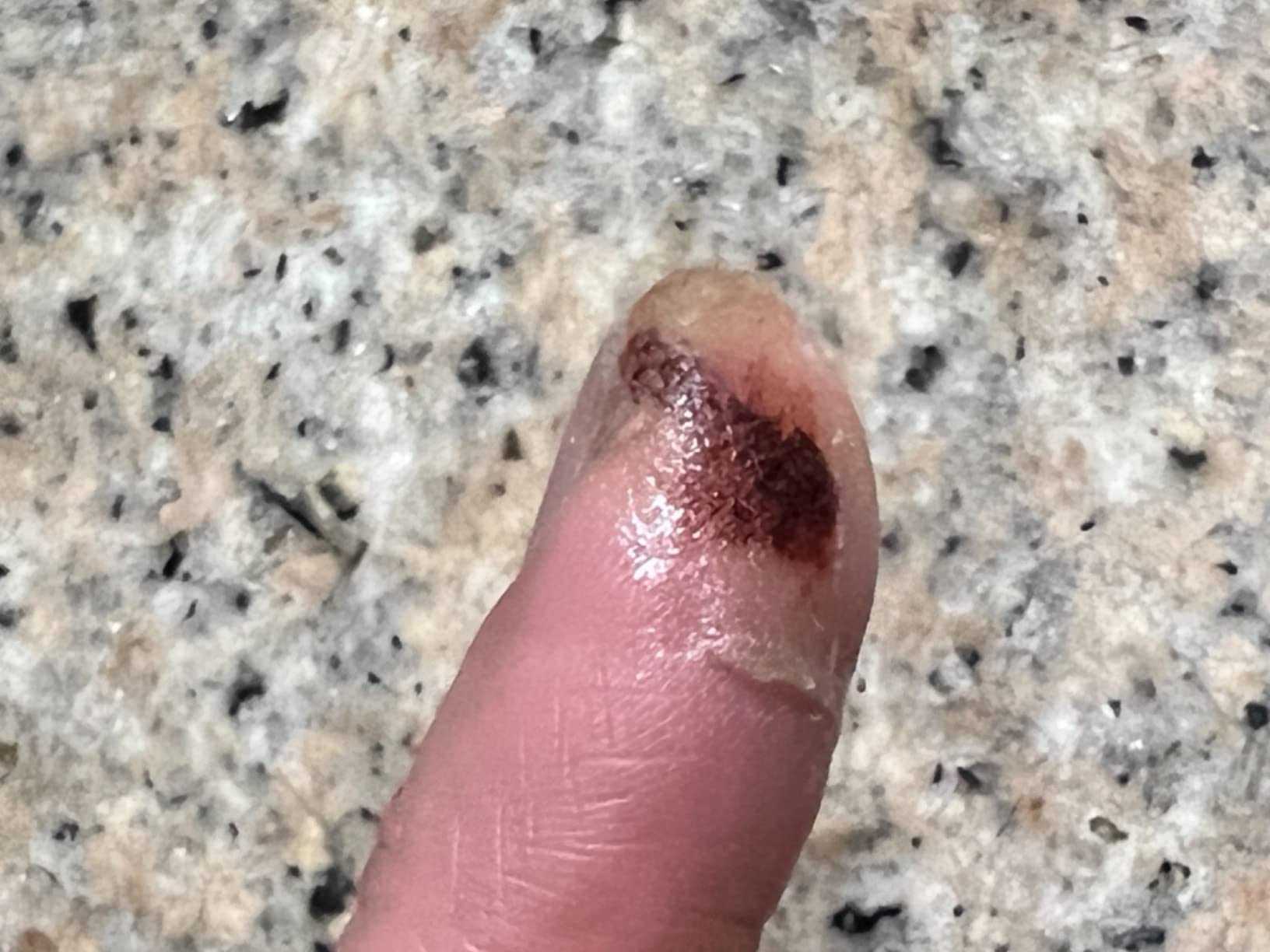 CURAD BloodStop Wound Dressing | 1