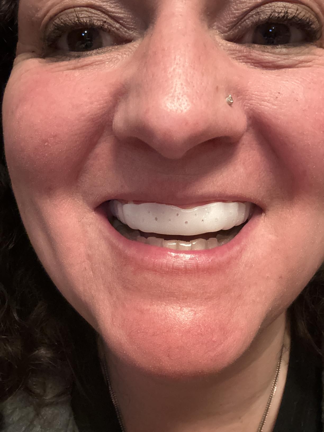 SOVA Aero Night Guard with Case - 1.6mm Thin - Custom-Molded Fit - Protects Against Nighttime Teeth Grinding & Clenching - Odor & Taste Free - Remoldable Up to 20 Times - Non Toxic customer photo 2