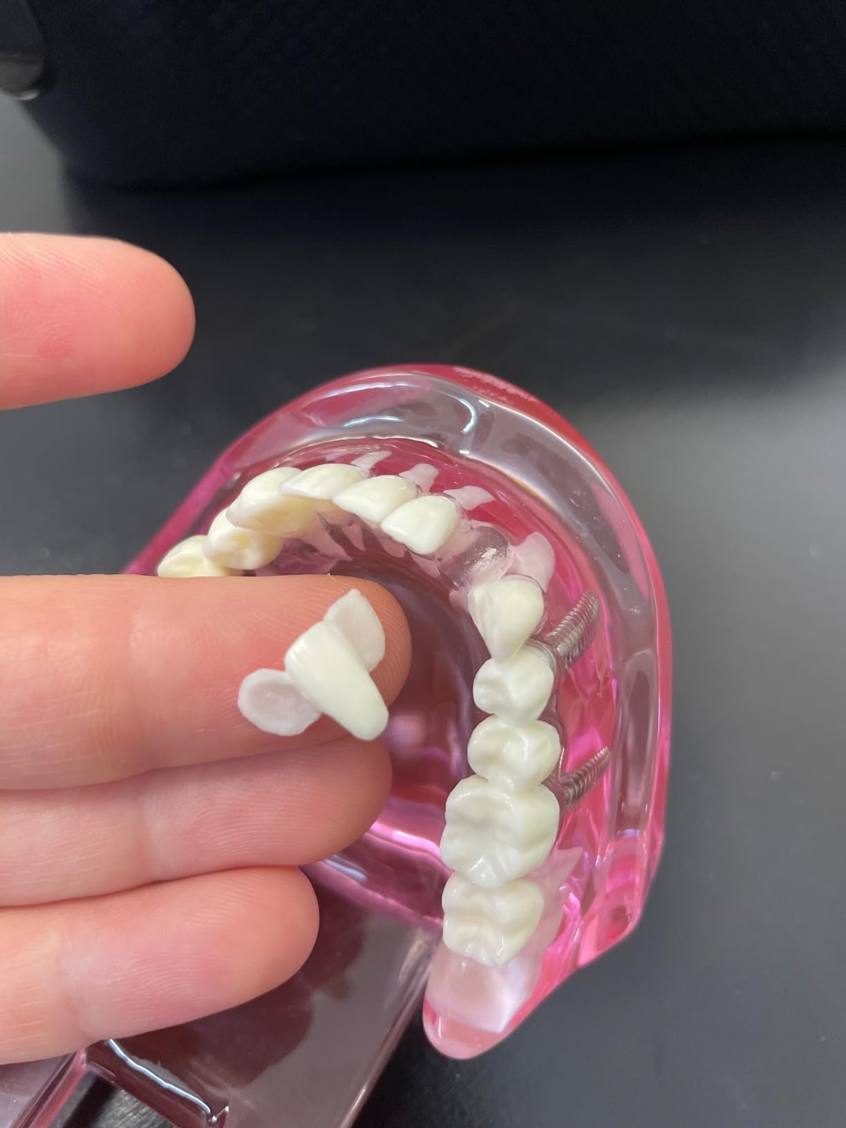 Teeth Model Teeth Typodonts Dental Implant Study Analysis Demonstration Teeth Model #2001 with Restoration Pink customer photo 2