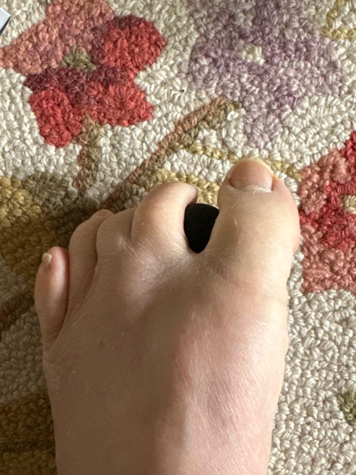 RAD Rounds - 3 Density Yoga Massage Ball Set for Deep Tissue Myofascial Release - Therapy Balls for Feet, Back, Neck, Jaw & Forearms - Trigger Point & Mobility Therapy (3-Pack) customer photo 2