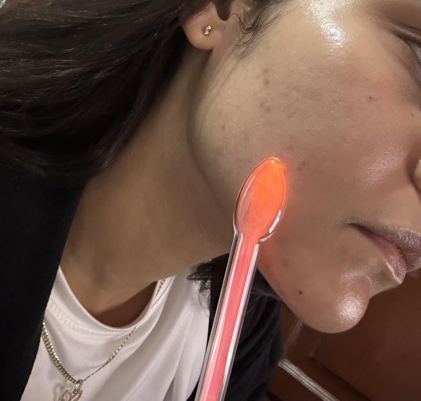 Pure Daily Care NuDerma Handheld Skin Therapy Wand Machine w/Neon - Anti-Aging - Skin Tightening - Wrinkle Reducing - Dark Circles - Clarifying - Hair & Scalp Stimulator customer photo 1