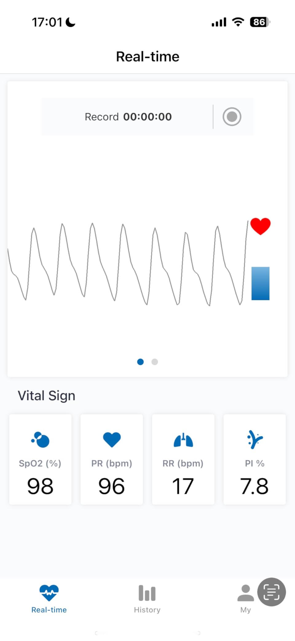 Innovo FSA/HSA Eligible iP900BP-B Fingertip Pulse Oximeter, Blood Oxygen Monitor with Free App, Plethysmograph, and Perfusion Index (with Bluetooth) customer photo 2