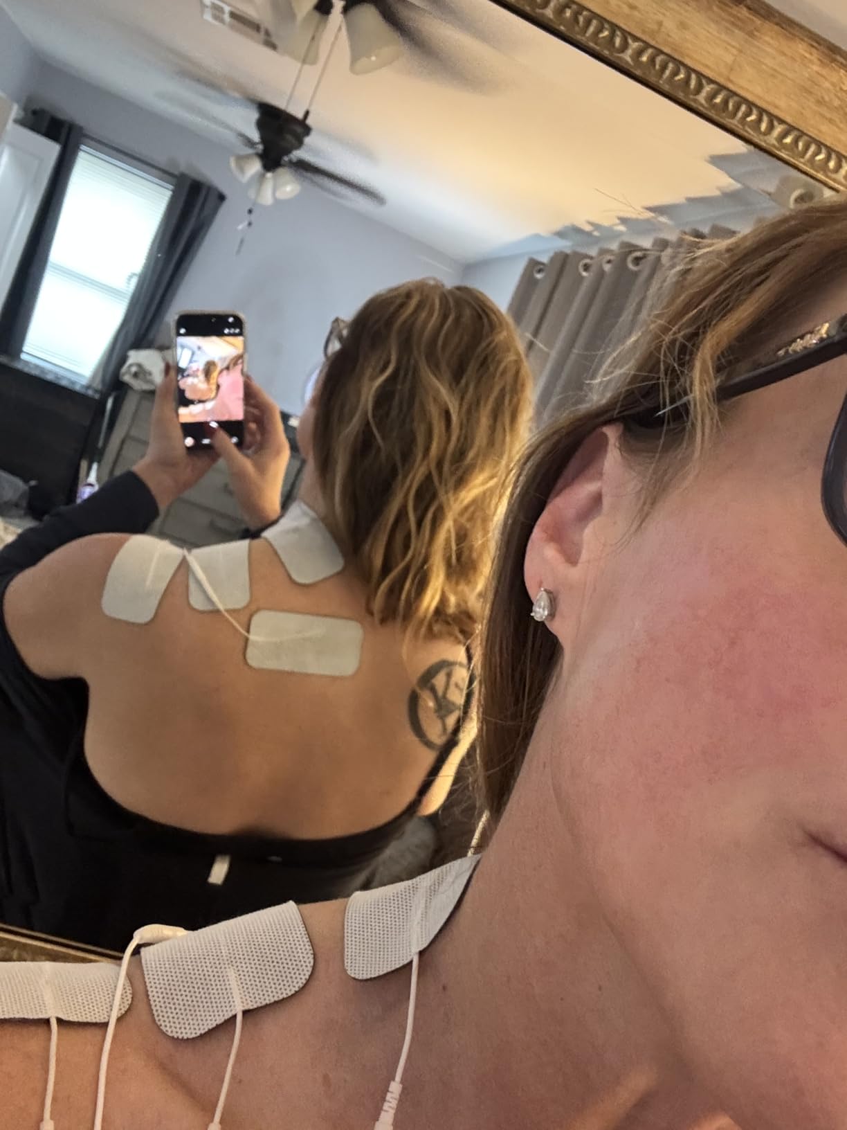 AUVON Dual Channel TENS Unit Muscle Stimulator Machine with 20 Modes, 2