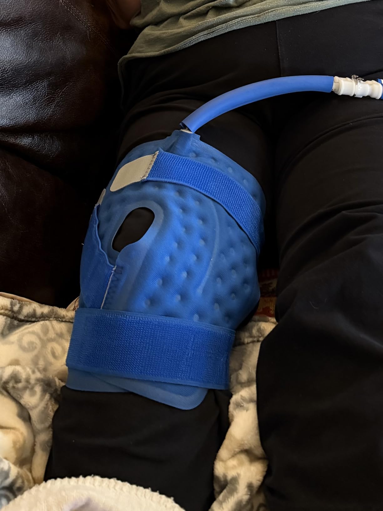 Polar Active Ice 3.0 | 9 QT Cold Therapy Ice Machine | Programmable Timer | Knee & Joint Pad | Cryotherapy Pain Relief System | Ace Bandage Style Compression customer photo 1