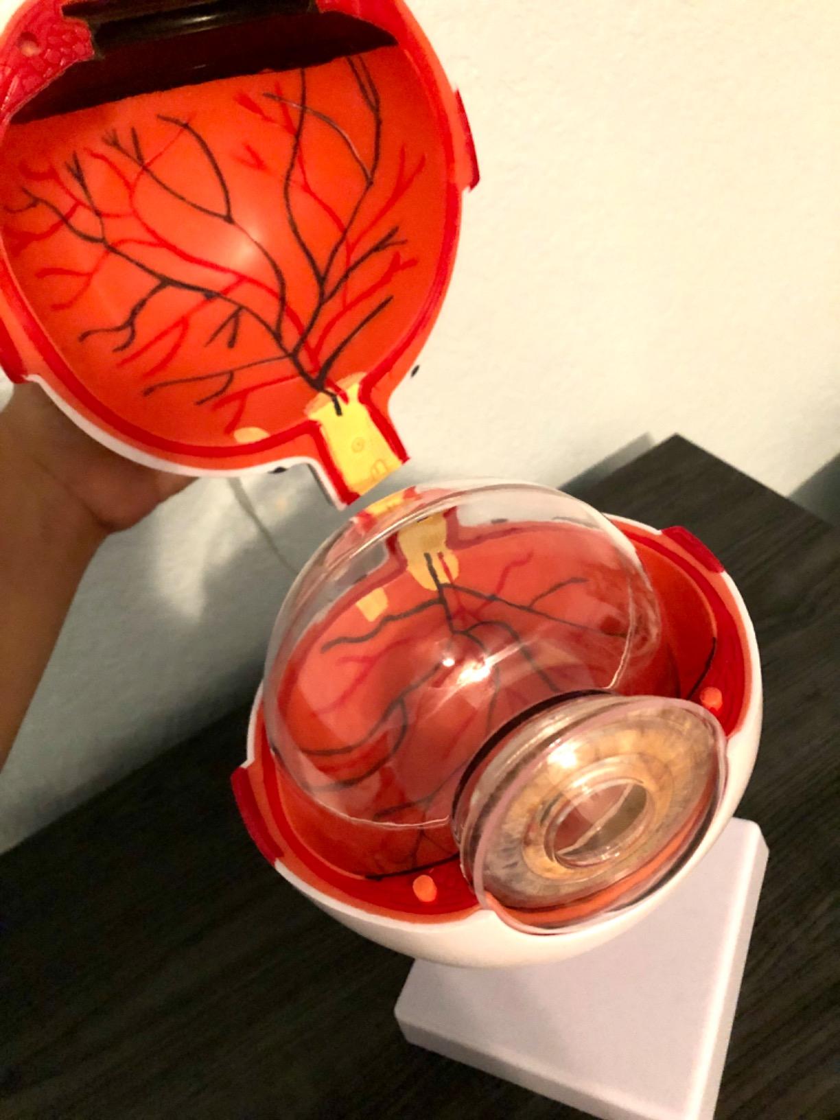 XINDAM 6X Enlarged Human Eye Anatomical Model - Accurate Anatomy for Science Classroom Study, Display, Teaching Medical Model customer photo 2