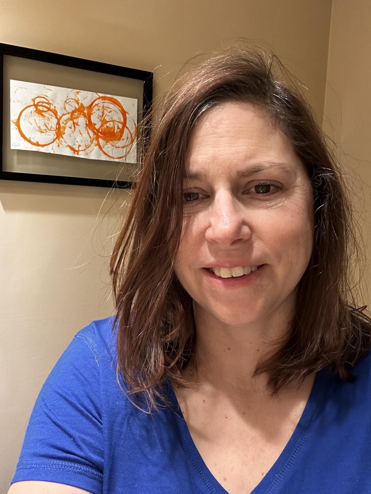 IceBeanie Migraine Relief Cap, As Seen on Shark Tank, Soft & Stretchy Gel Tension Headache Relief Cap, Extended Cooling Hangover Ice Hat, Odorless Head Wrap Ice Pack Wrap, Headache Migraine Mask customer photo 1