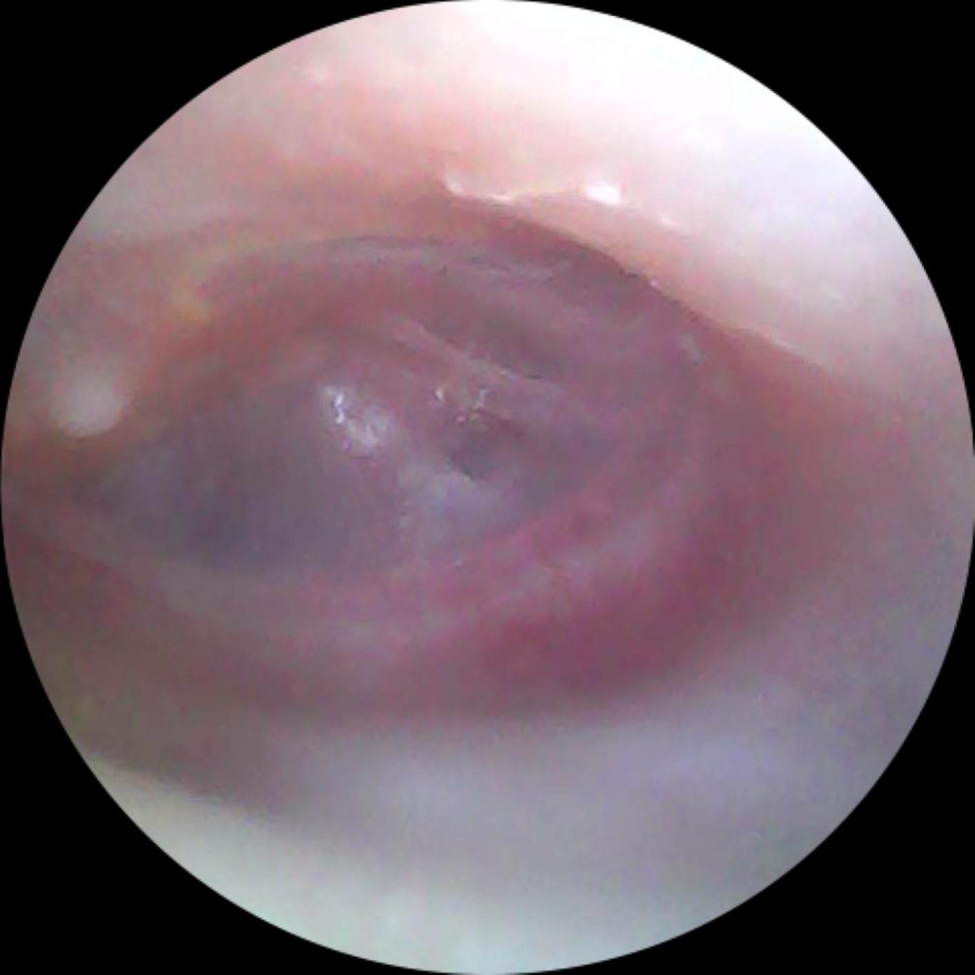 ScopeAround Otoscope with Light, Otoscope Camera w/Dual View, 720pHD WiFi Ear Scope w/ 6 LED Lights, Ear Camera 3.9mm Lens for Kids & Adults, Ear Scope Compatible w/Android & iPhone customer photo 2