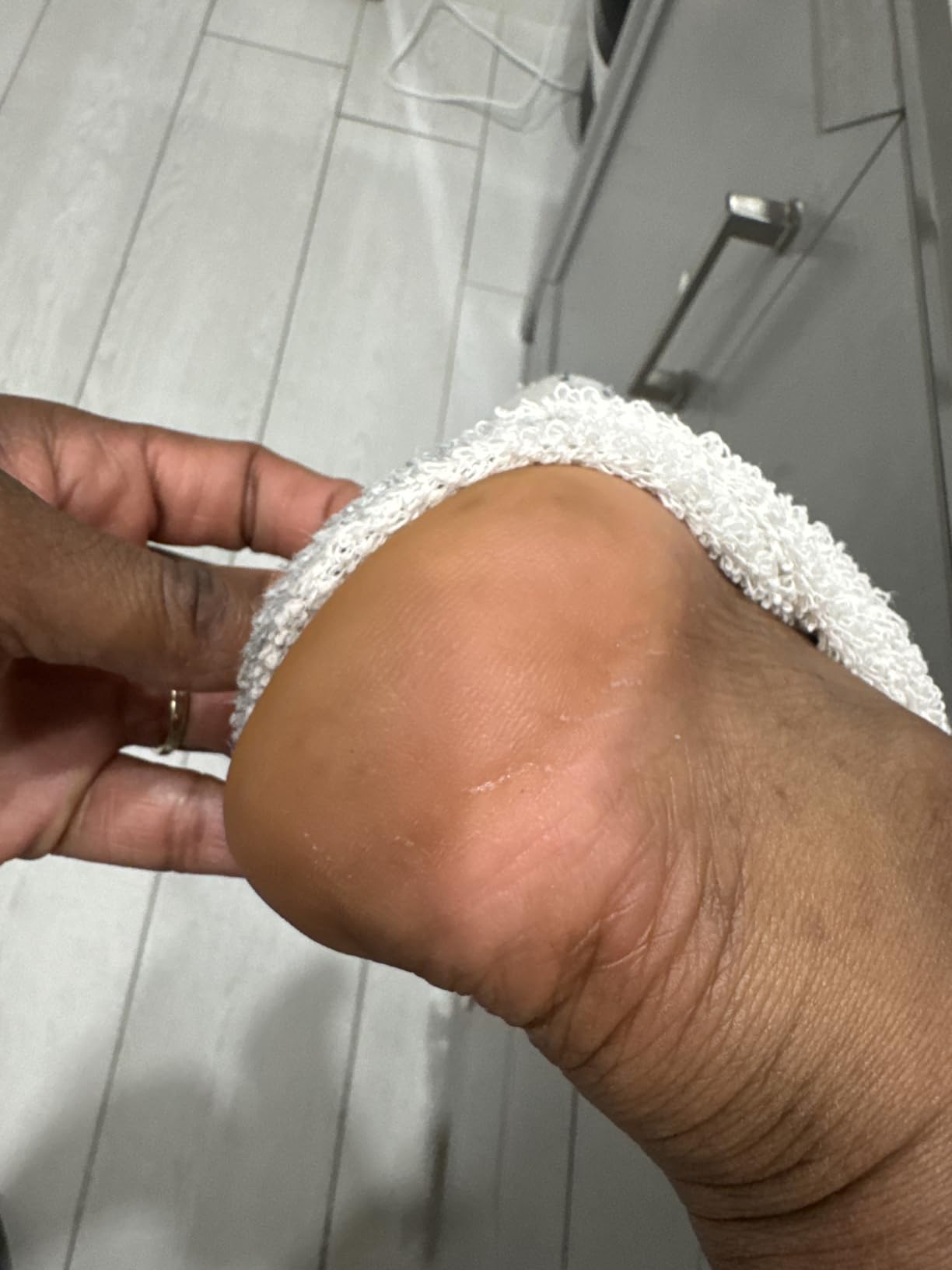 Ebanel Urea Cream 40% plus Salicylic Acid 2%, Foot Cream for Dry Cracked Heels Feet Knees Elbows Hands customer photo 2