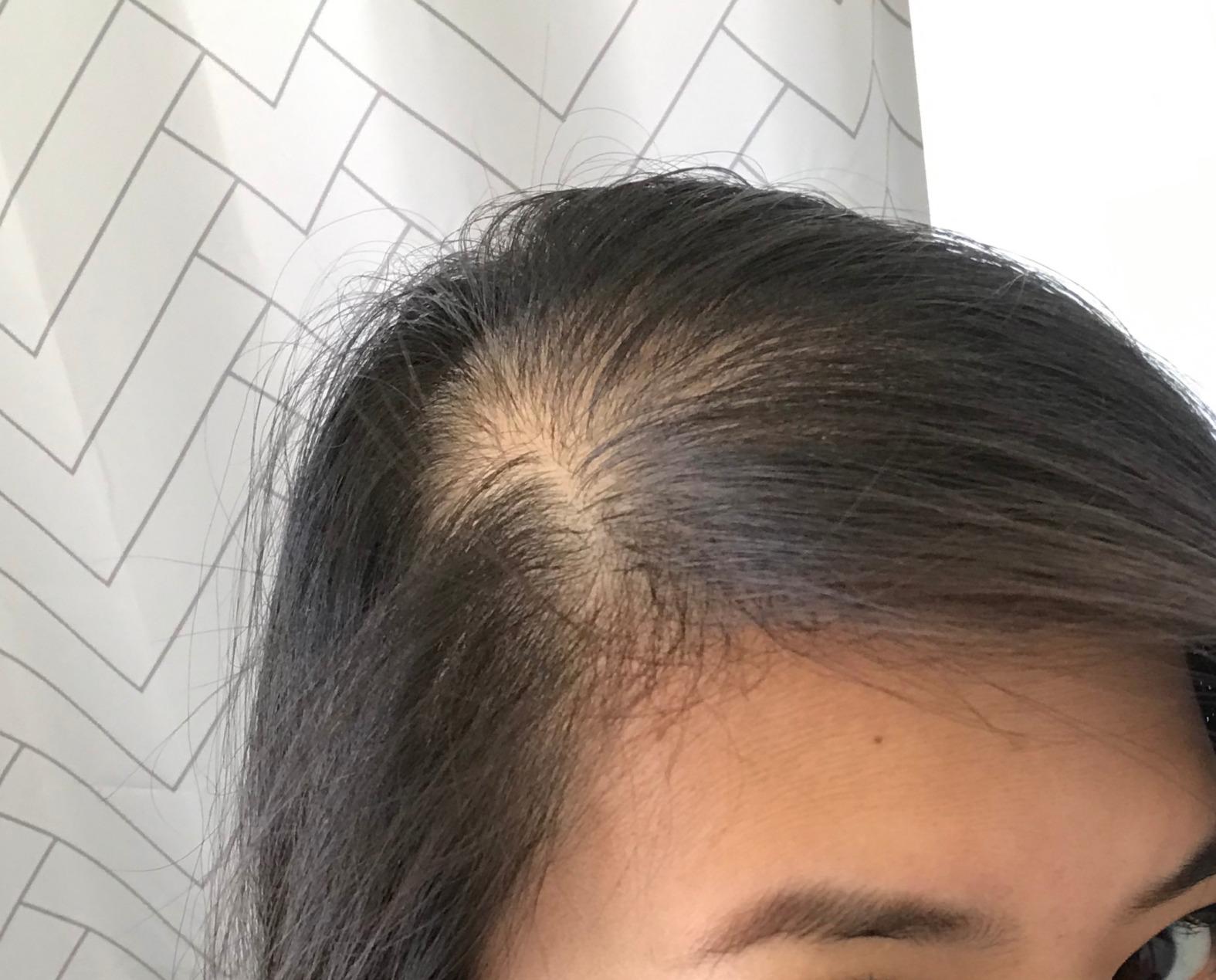 BOLDIFY Hair Fibers (12g) - Fill In Thinning and Fine Hair for an Instantly Fuller, Thicker Look - 14 Shades for Women & Men - Dark Brown customer photo 2