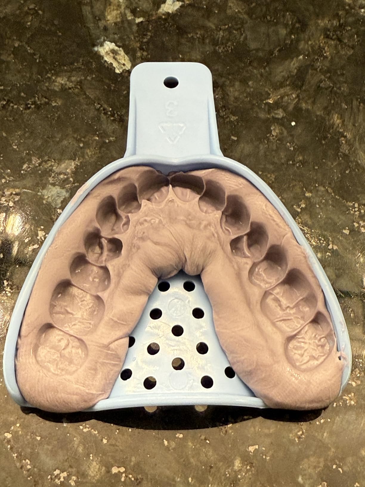 ClearClub | Custom Dental Night Guard for Teeth Grinding & Clenching, Relieve Soreness in Jaw Muscles | 2mm Upper Guard | 1 Guard Kit customer photo 2