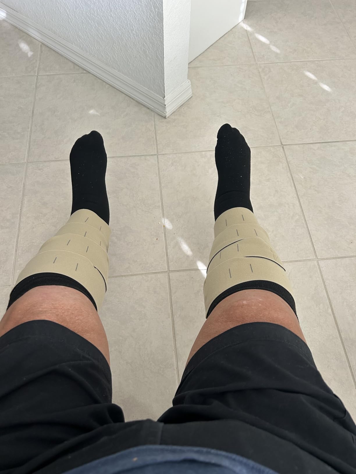 CircAid Juxtalite Lower Leg System - Easy to Use Adjustable Compression Level Garment for Men & Women customer photo 1