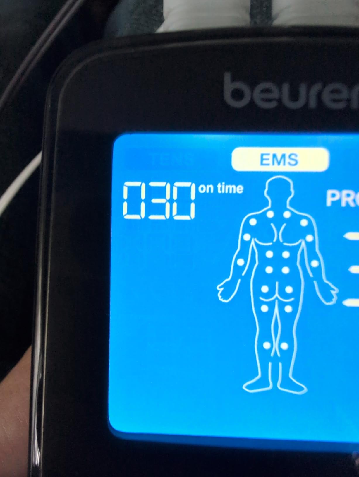 Beurer EM59 Digital 3-in-1 TENS Unit, EMS & Heat Therapy for Pain Relief & Relaxation, Muscle Stimulator with 2 Adjustable Channels, 64 Applications, Timer Function customer photo 1