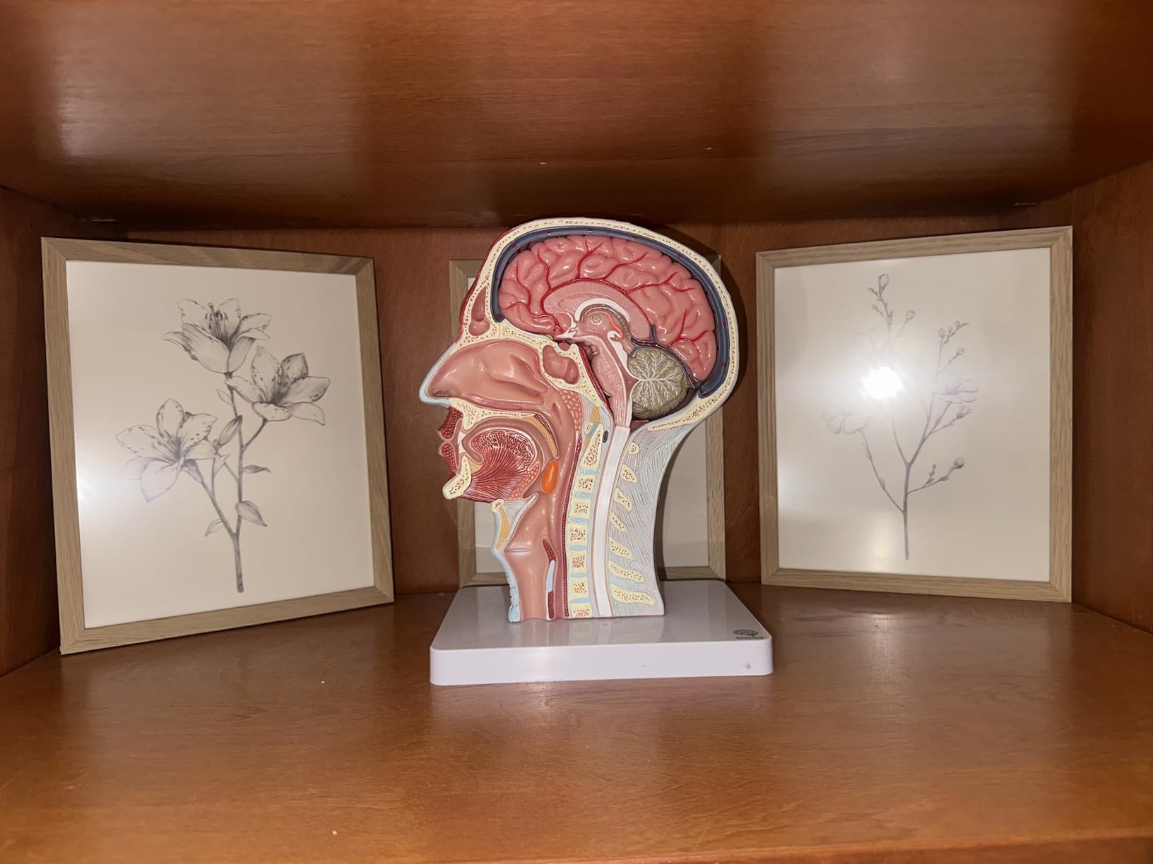 EVOTECH SCIENTIFIC Human Half Head Superficial Neurovascular Model with Musculature, Life Size Anatomical Head Skull and Brain Model for Medical Science Teaching Learning Education Display customer photo 2